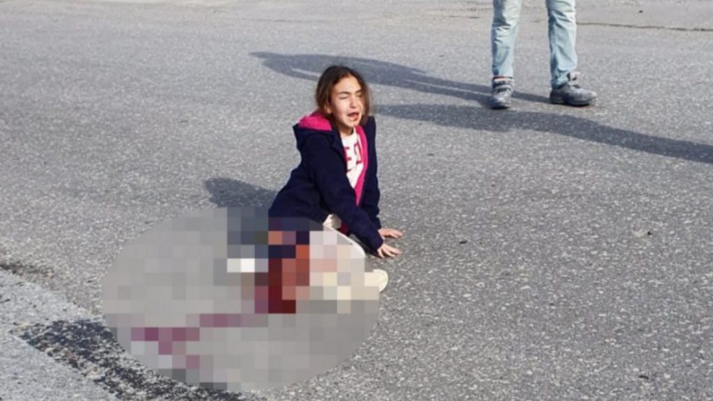 Antalya’da yaşam mücadelesi veren Mahra kurtarılamadı