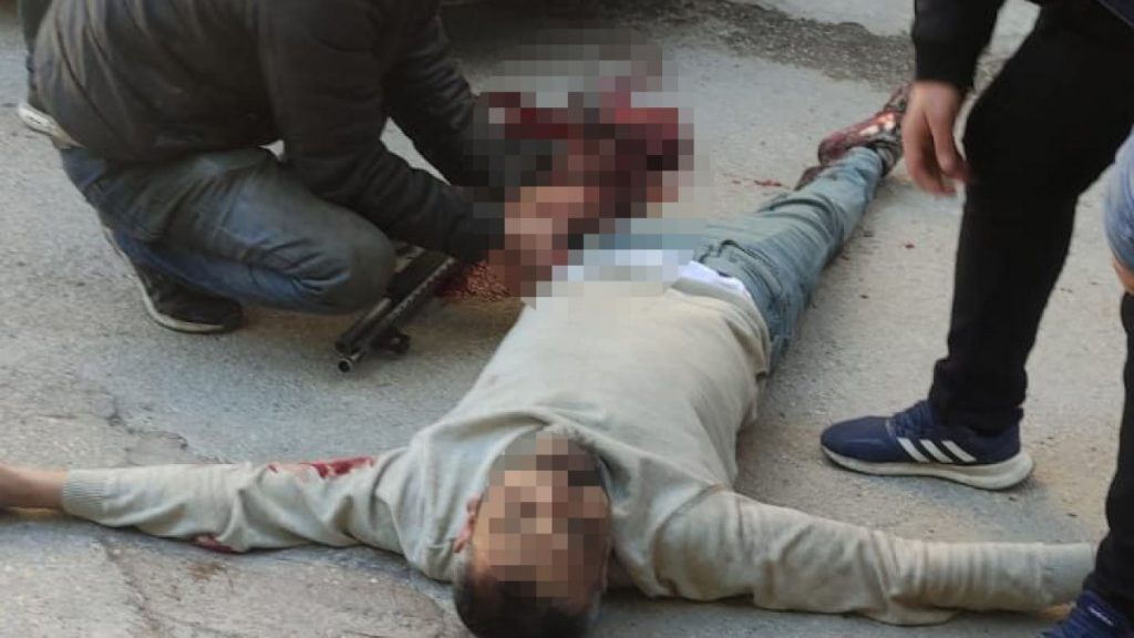 Adana’daki otoparkçı, bıçaklı 3 saldırganı silahla yaraladı