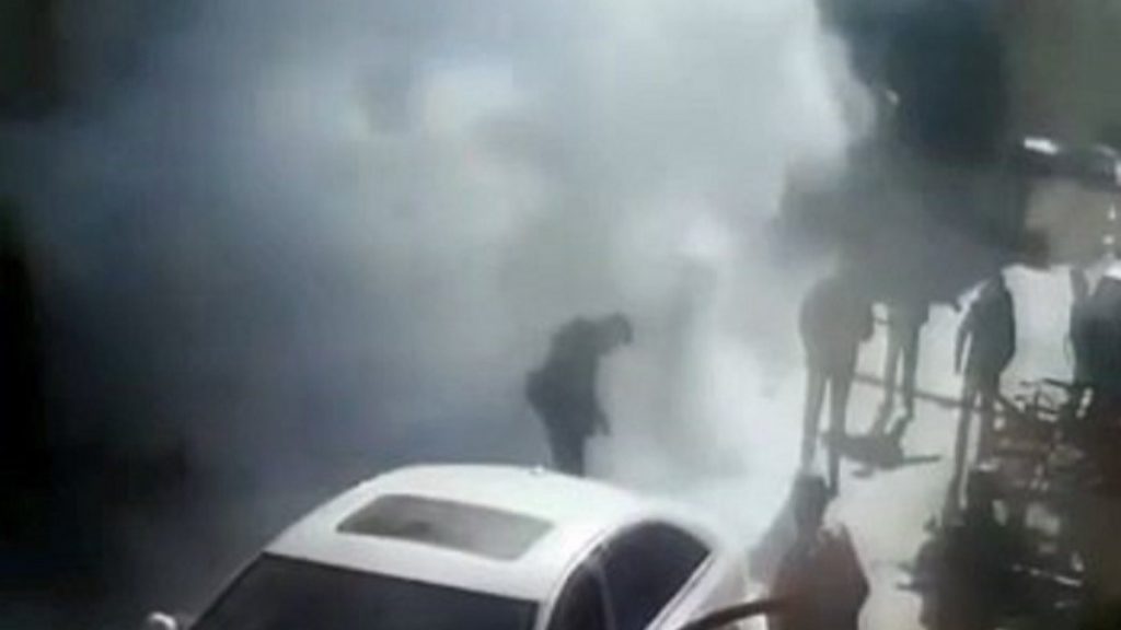 Kastamonu’da sobadan sıçrayan alev, stajyer genci hastanelik etti