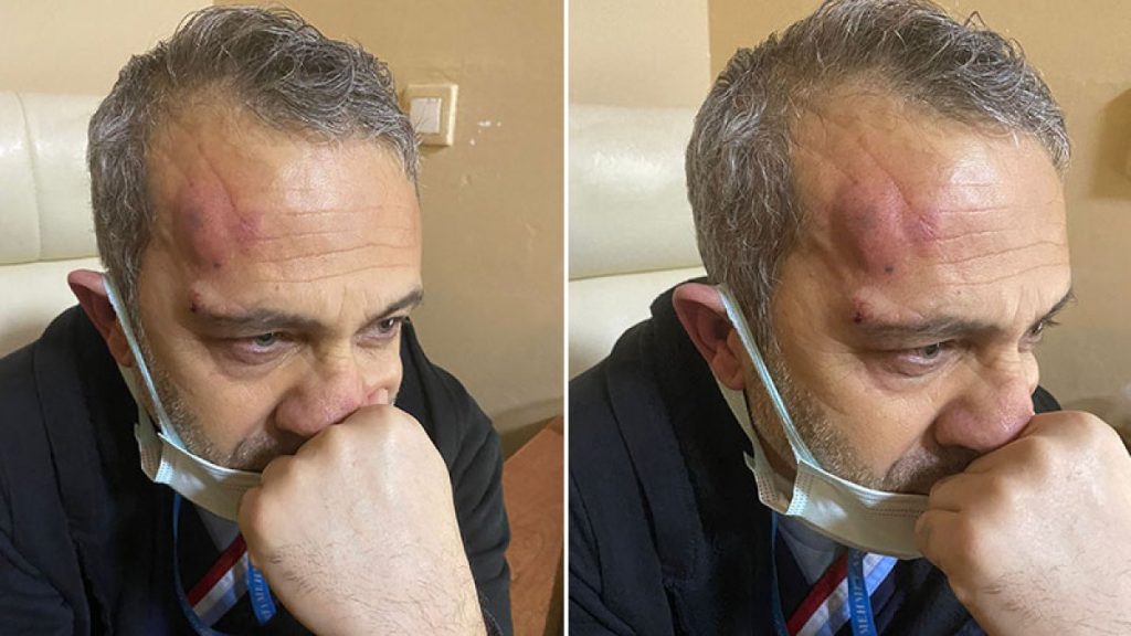 Şanlıurfa’da hemşireyi darbeden 2 hasta yakını tutuklandı